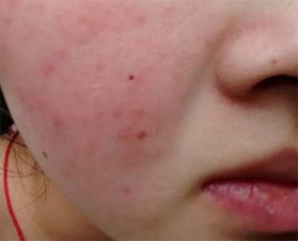 Skin moisturizing essential oil